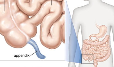 Appendix